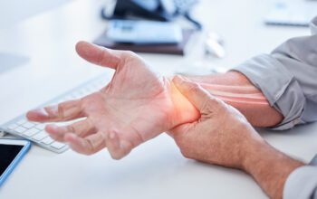 Arthritis Management